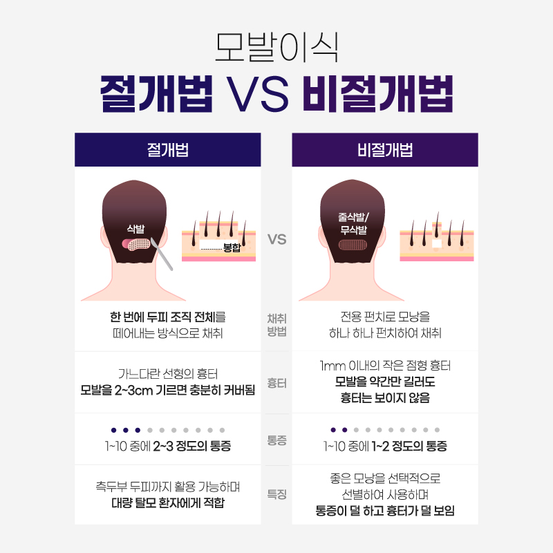 절개, 비절개 모발이식 차이점 설명 이미지